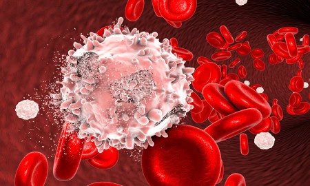 Blood Cancer Istock 623945252