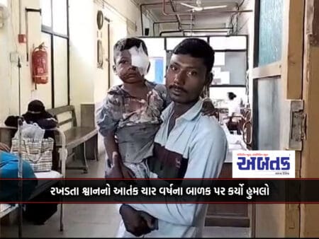 A Four-Year-Old Child Was Attacked By Stray Dogs In Halar District