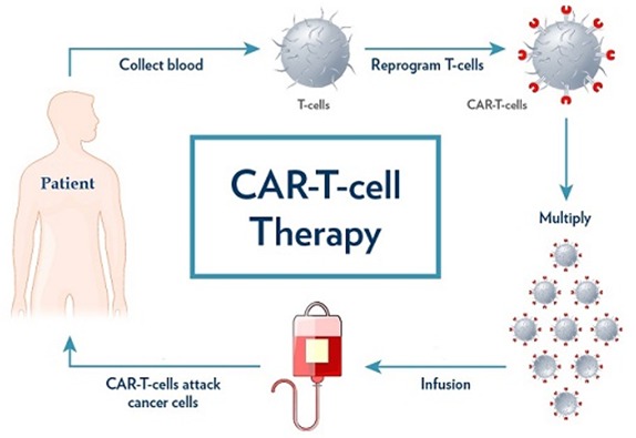 Made in India: CAR T-cell therapy will treat cancer at a lower cost
